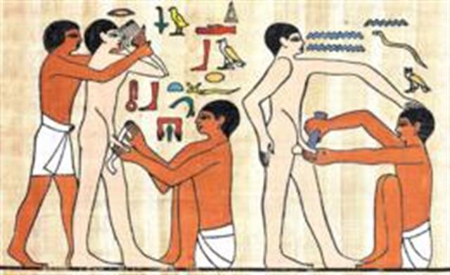Parece que la circuncisión la hacían cuando los hombres ya tenían uso de razón.
