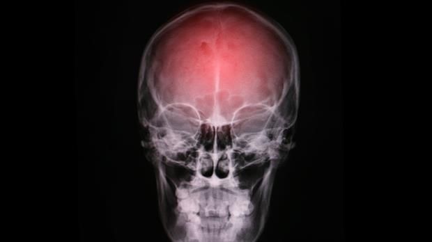 Día mundial del cerebro